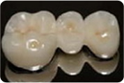 Dentalna protetika
