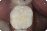Estetska i konzerv. dentalna medicina